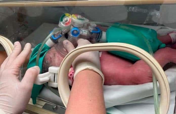 Las menores nacieron el 15 de marzo en el Hospital Regional Materno Infantil, reportó el gobierno de Nuevo León en un comunicado.